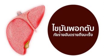 อาหารเสริมบำรุงตับ เห็ดหลินจือแดง ลดไขมันพอกตับและตับแข็ง